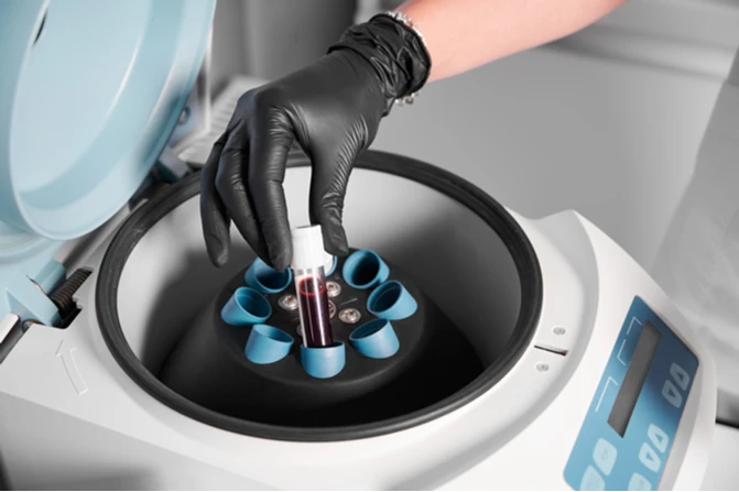 Biochemistry analyser working principle